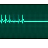   Liniendiagramm, Herzfrequenz, Frequenz